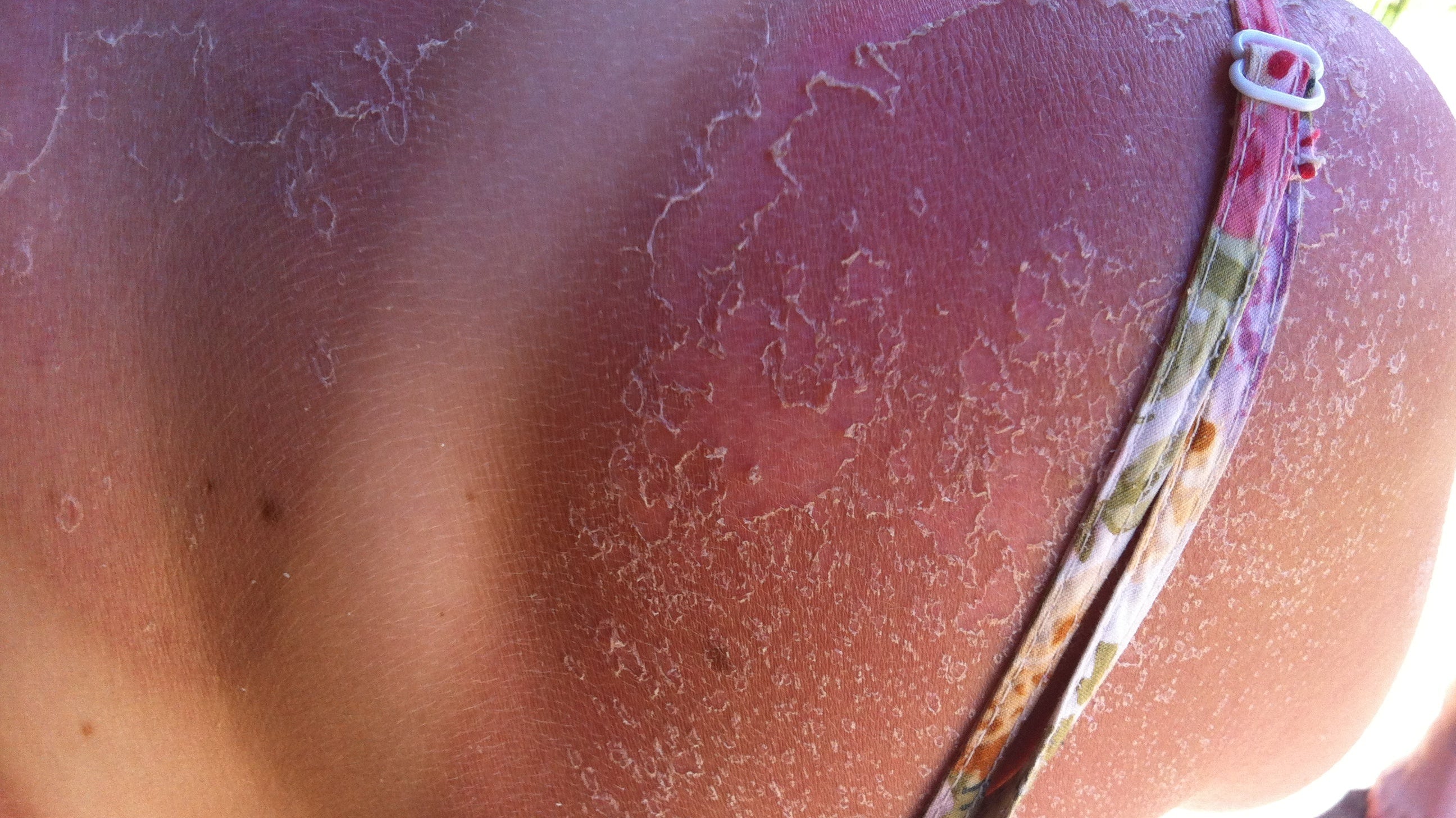 SOS - save our skin!! UPF and all that.