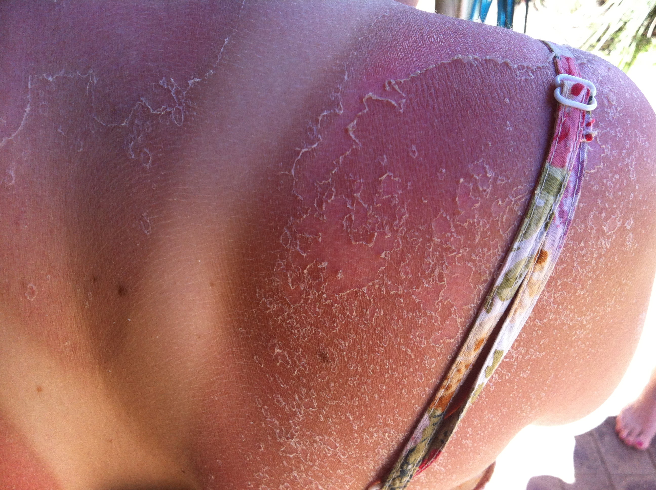 SOS - save our skin!! UPF and all that.